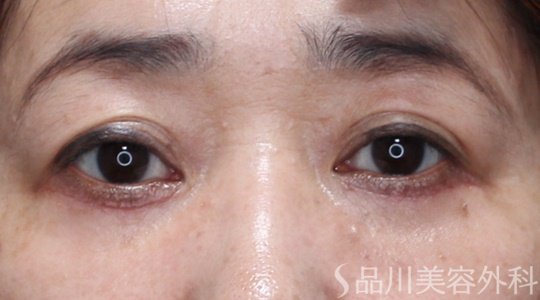 症例NO.65912のAFTER写真
