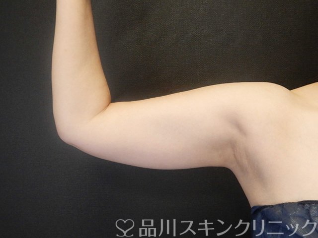 症例NO.66305のBEFORE写真