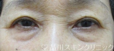 症例NO.71789のBEFORE写真