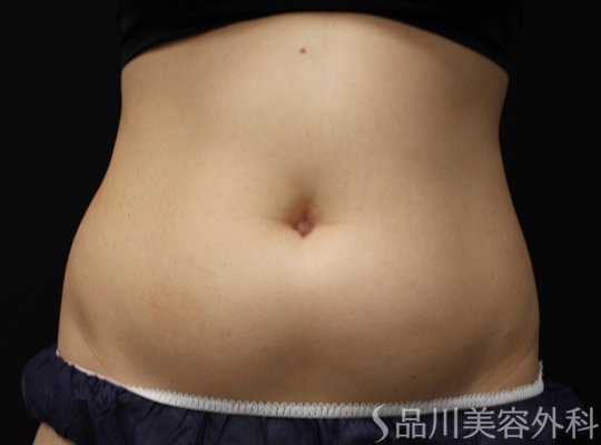 症例NO.75139のBEFORE写真