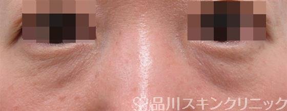 症例NO.33491のBEFORE写真