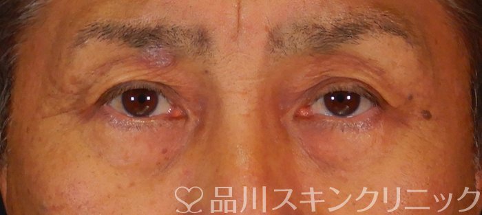 症例NO.66631のAFTER写真