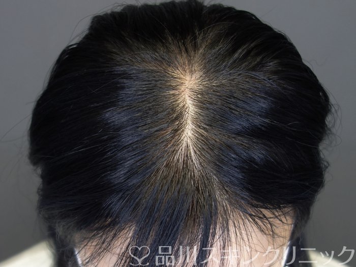 症例NO.73646のAFTER写真