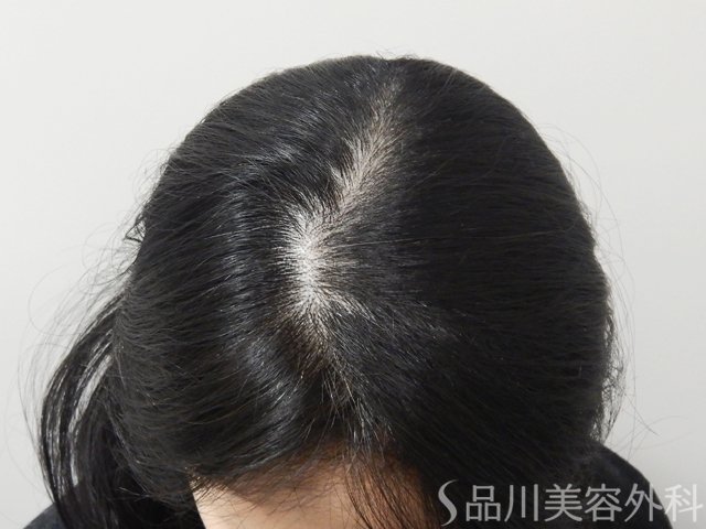 症例NO.73284のBEFORE写真