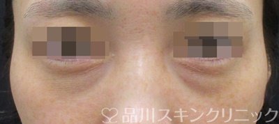 症例NO.69591のBEFORE写真