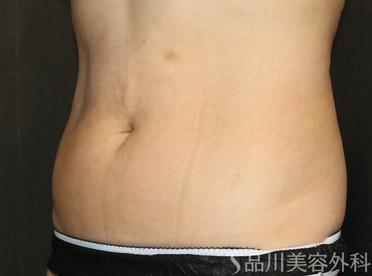症例NO.75121のBEFORE写真