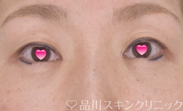 症例NO.69526のAFTER写真