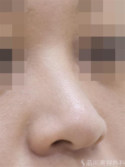 症例NO.50389のBEFORE写真