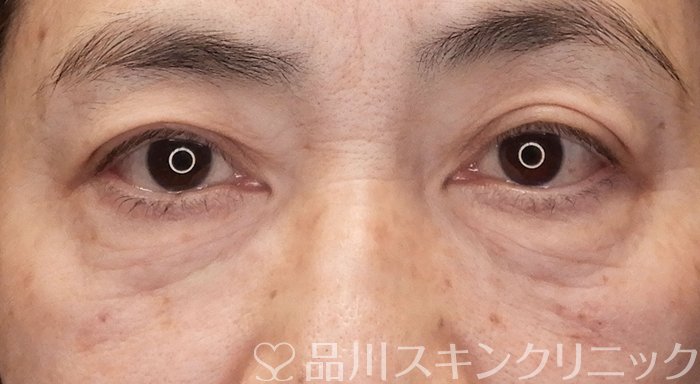 症例NO.70629のAFTER写真
