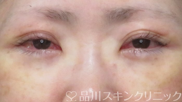 症例NO.68999のAFTER写真