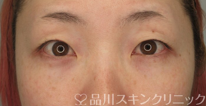 症例NO.73710のBEFORE写真