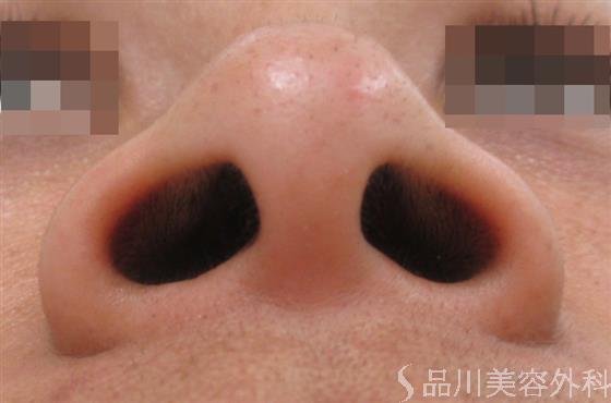症例NO.21357のBEFORE写真