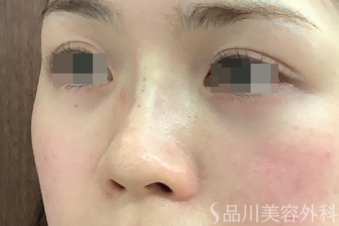 症例NO.63002のAFTER写真
