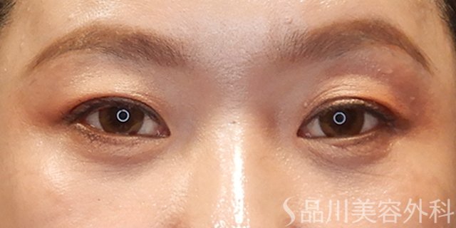 症例NO.73297のAFTER写真