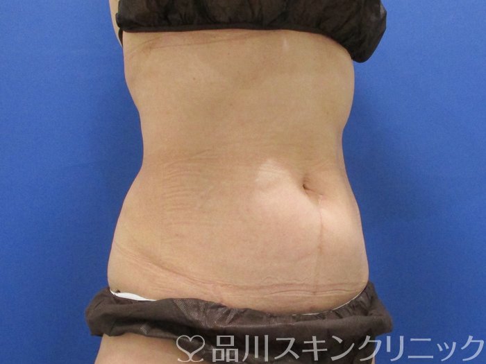 症例NO.69803のBEFORE写真