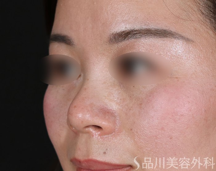 症例NO.73104のBEFORE写真