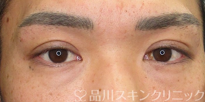 症例NO.73021のAFTER写真