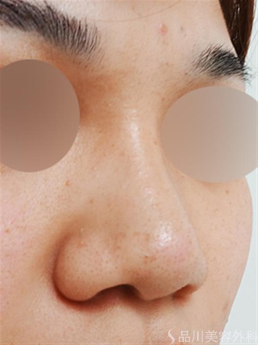 症例NO.30271のAFTER写真