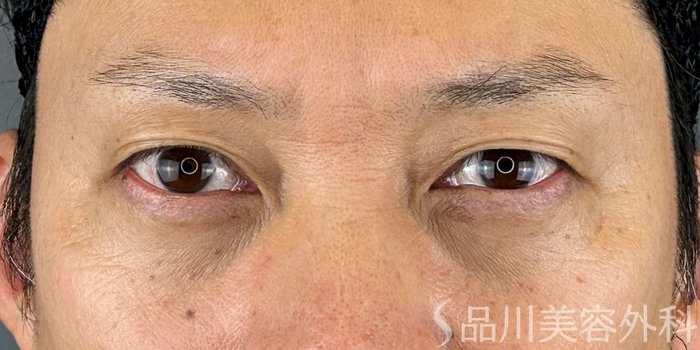 症例NO.70304のAFTER写真