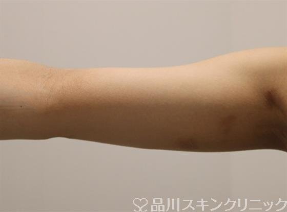 症例NO.47129のAFTER写真