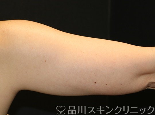 症例NO.70036のAFTER写真