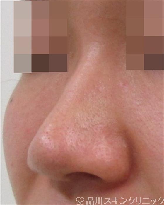 症例NO.34269のBEFORE写真
