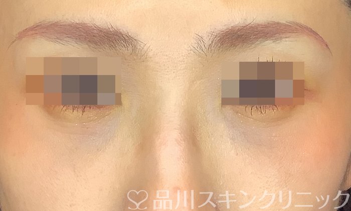 症例NO.71802のAFTER写真