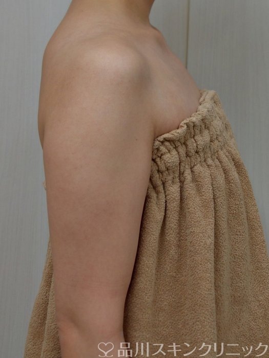 症例NO.73457のBEFORE写真