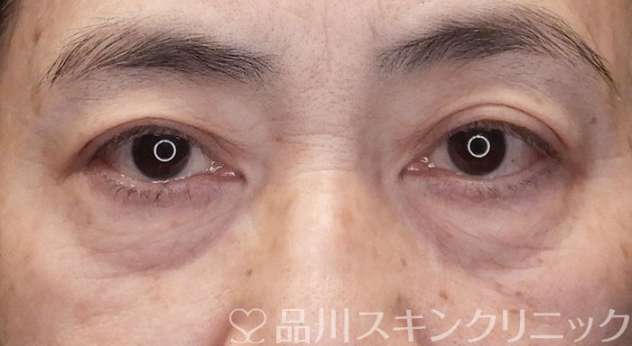 症例NO.70629のBEFORE写真