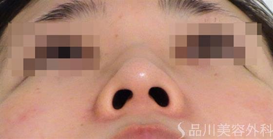症例NO.37982のBEFORE写真
