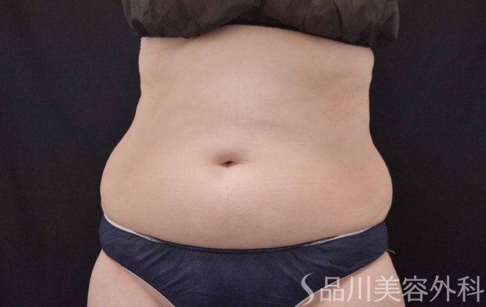 症例NO.68567のBEFORE写真