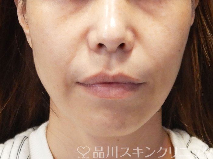 症例NO.73001のBEFORE写真