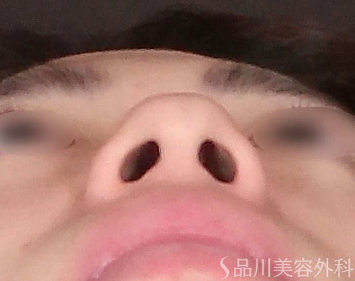 症例NO.70016のBEFORE写真
