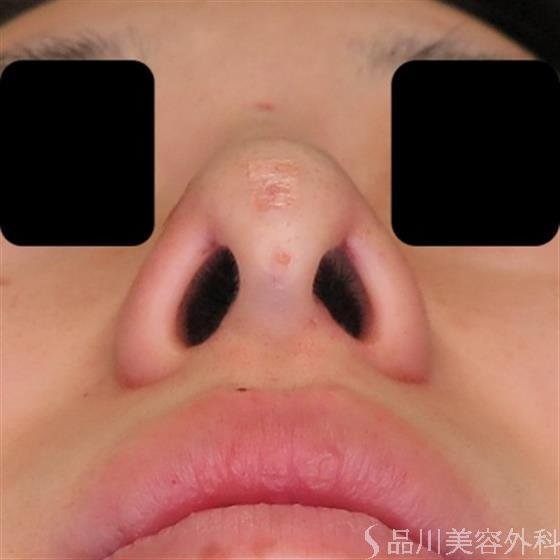 症例NO.50190のAFTER写真