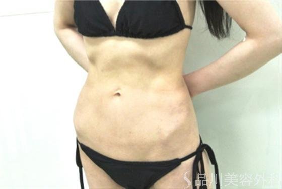 症例NO.18066のAFTER写真