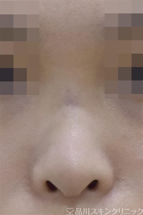 症例NO.60191のBEFORE写真