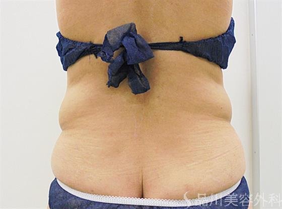 症例NO.22255のBEFORE写真