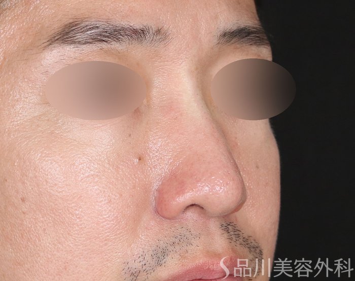 症例NO.71673のAFTER写真