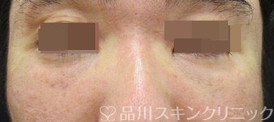 症例NO.70453のAFTER写真