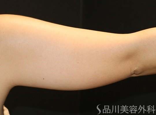 症例NO.75207のBEFORE写真