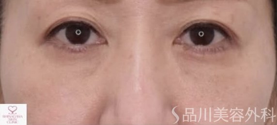 症例NO.72271のAFTER写真