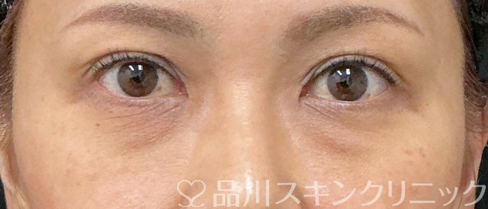 症例NO.74873のBEFORE写真
