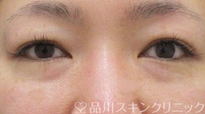 症例NO.65363のBEFORE写真
