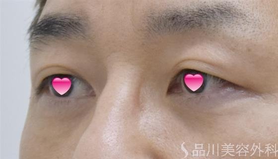 症例NO.50256のAFTER写真