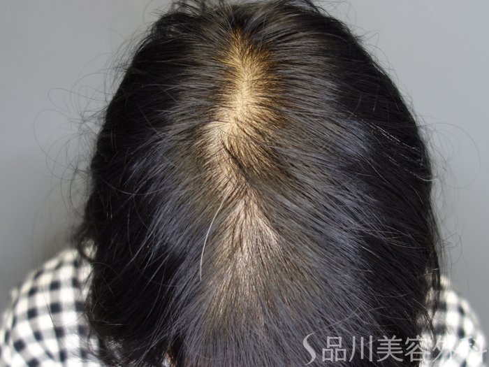 症例NO.74621のBEFORE写真