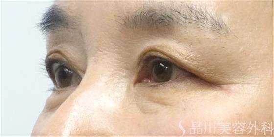 症例NO.21037のBEFORE写真