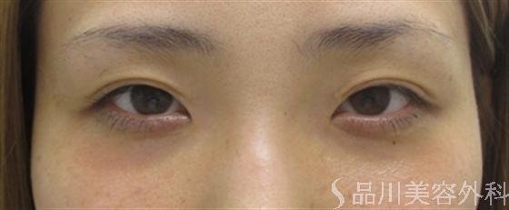 症例NO.6571のBEFORE写真