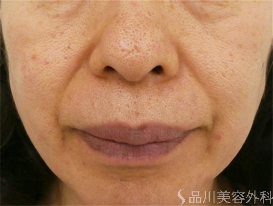 症例NO.20789のBEFORE写真