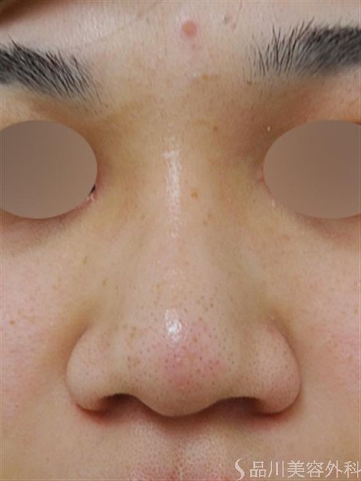 症例NO.30271のAFTER写真
