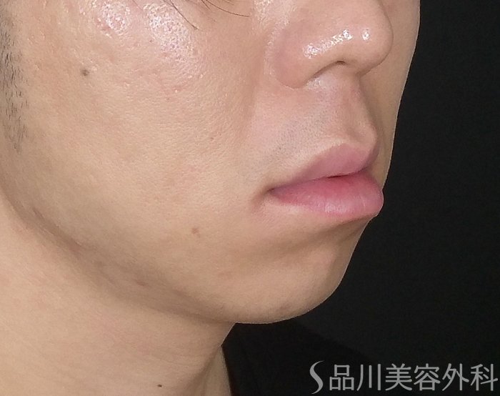 症例NO.67602のBEFORE写真